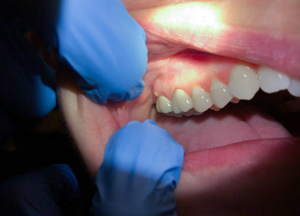 Best Same-Day Emergency Dentist in Brighton, IL