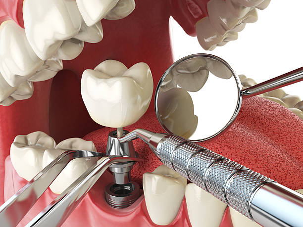 Best Emergency Dental Surgery in Brighton, IL